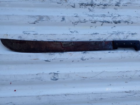 Violenta riña con machete: tres hombres heridos y aprehendidos tras el enfrentamiento