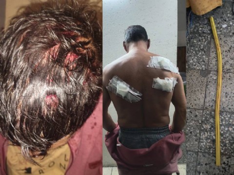 Tolosa: atacó brutalmente con un caño de gas y apuñaló a la actual pareja de su ex esposa