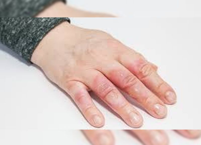 Una abogada fue torturada por tres delincuentes en un robo en su casa de Barrio Norte