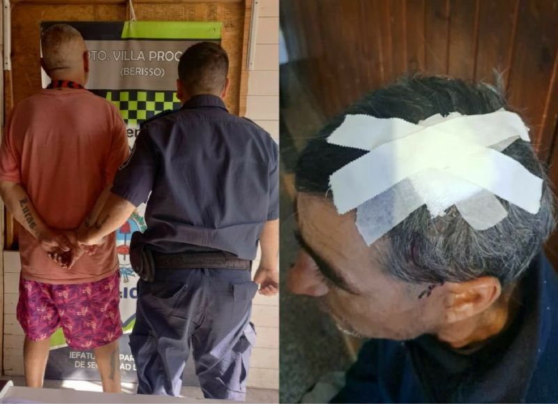 Berisso: un limpiavidrios fue brutalmente atacado por un taxista