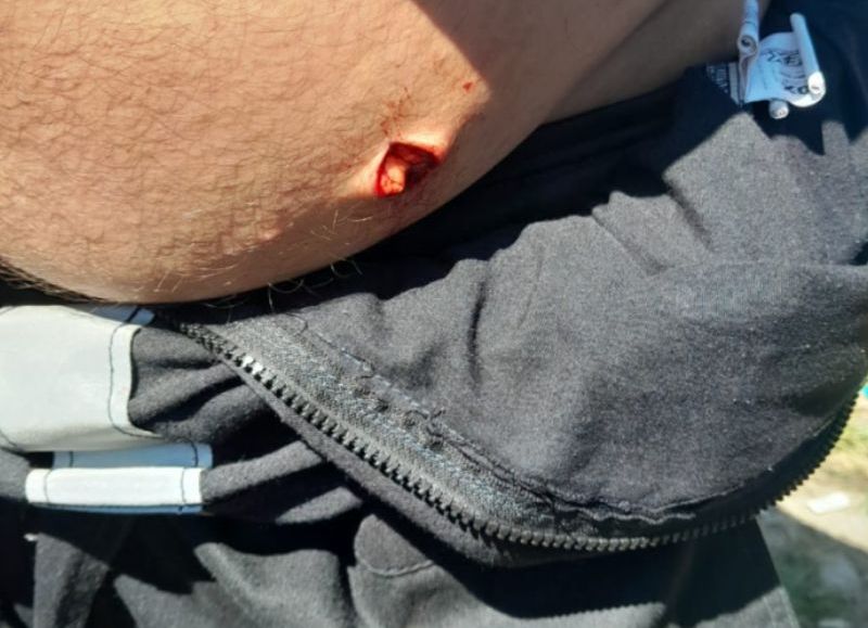 Arde UOCRA La Plata: un obrero apuñalado, una casa baleada y viene una noche difícil