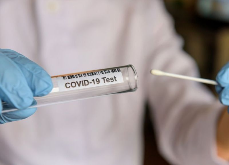 Covid en Berisso: 21 nuevos contagios, dos fallecimientos y 904 casos activos