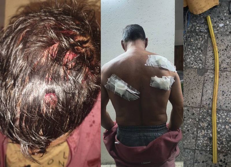 Tolosa: atacó brutalmente con un caño de gas y apuñaló a la actual pareja de su ex esposa